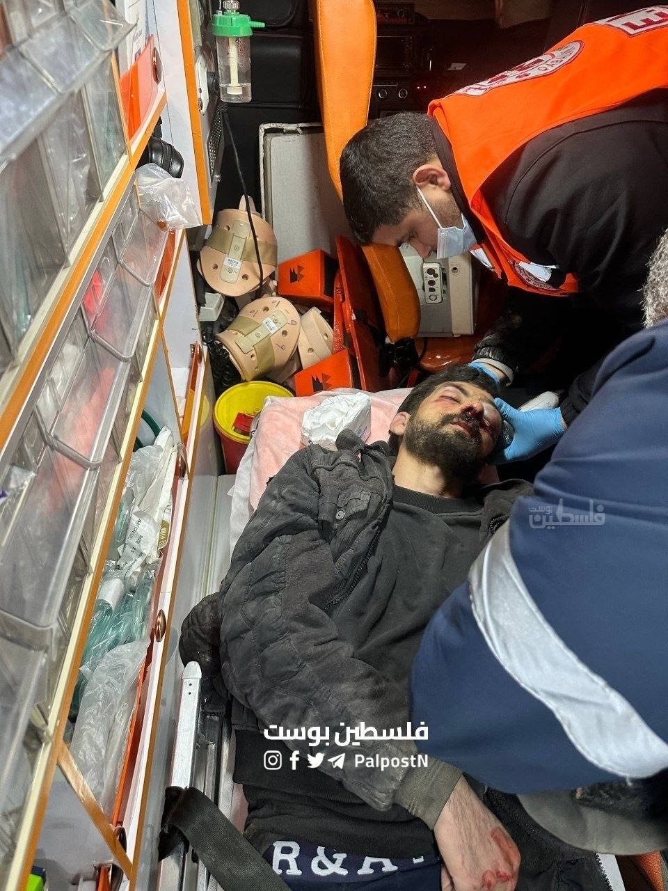 مستوطنون يعتدون بوحشية على شاب ويحرقون بركسين خلال هجومهم على قصرة